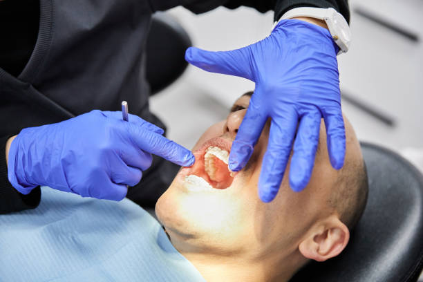 Best Emergency Tooth Extraction in Fayetteville, WV